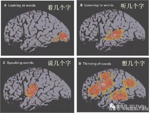 中國腦健康日關(guān)注“頭”等大事，中國腦科技的未來是什么？